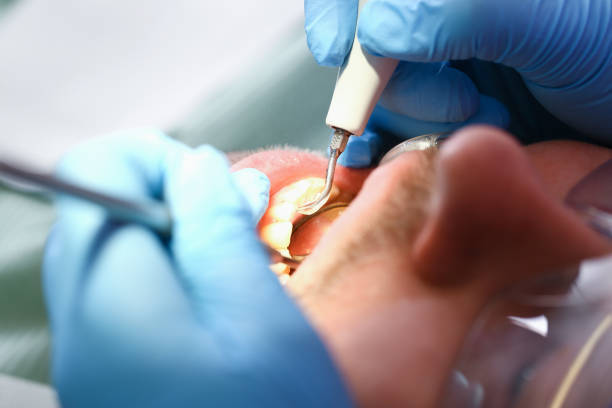 Best Knocked-Out Tooth Emergency  in Cresskill, NJ