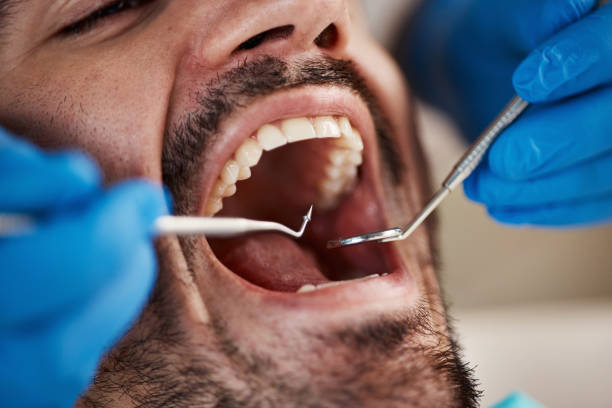 Best Root Canal Emergency Dentist  in Cresskill, NJ
